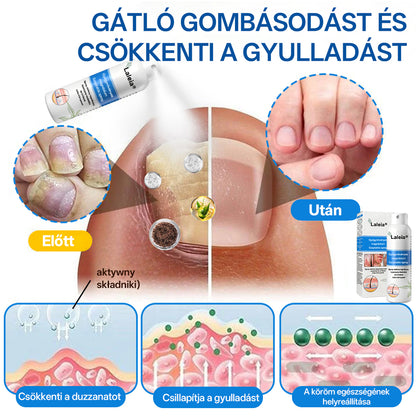 ⭐Laleia® 🎉Magnézium Gyógynövényes Pszoriázis Spray