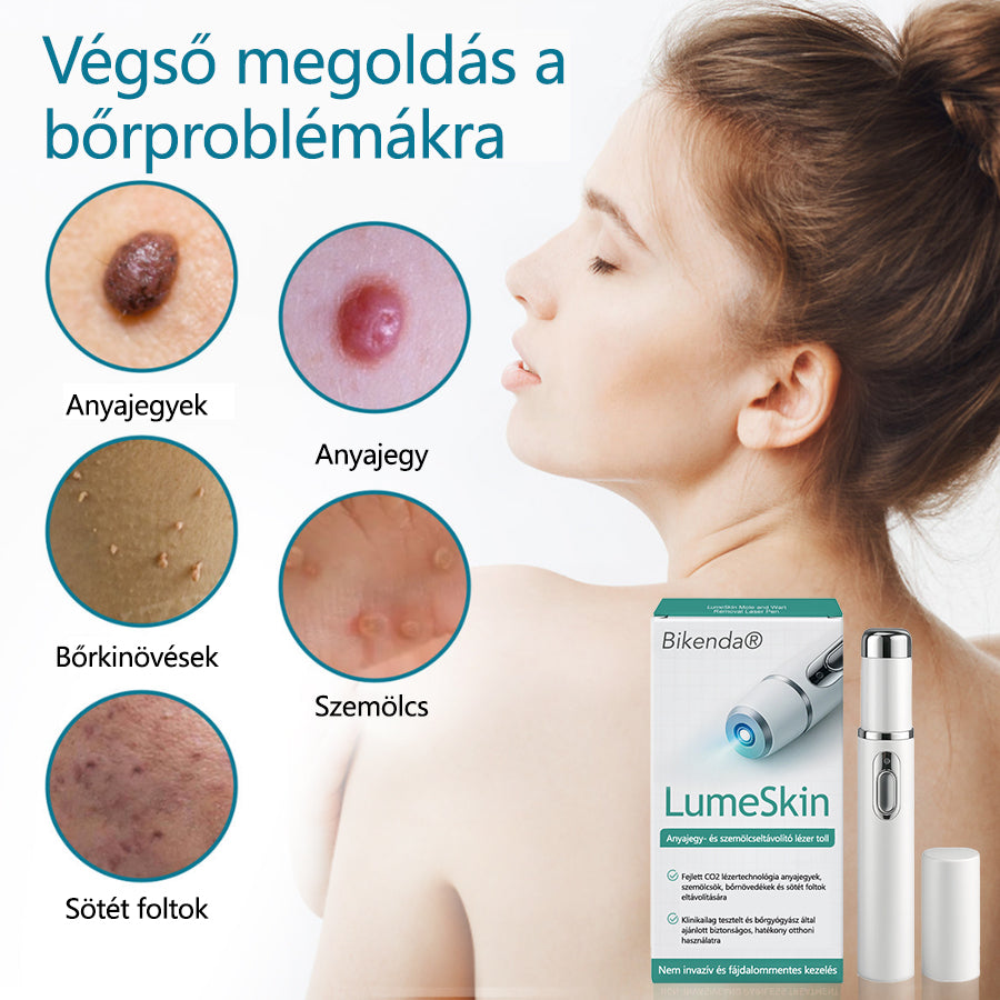 ✅Bikenda® LumeSkin anyajegy és szemölcs eltávolító lézeres toll