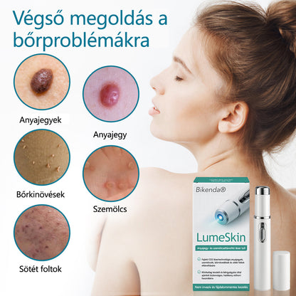 ✅Bikenda® LumeSkin anyajegy és szemölcs eltávolító lézeres toll