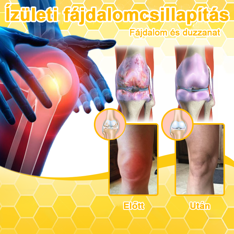Aeehfeng™ méhméreg és kurkuma ízületi gyulladás terápiás krém (👩 🔬ortopédiai állapotokra és ízületi fájdalmakra👩 🔬 specializálódott)