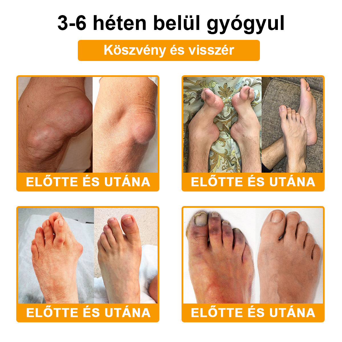 TLOPA® Botulinum Toxin és Méhméreg Fájdalomcsillapító Csontgyógyító Krém🐝 🔥(Kifejezetten időseknek & ortopéd szakorvosok ajánlásával)