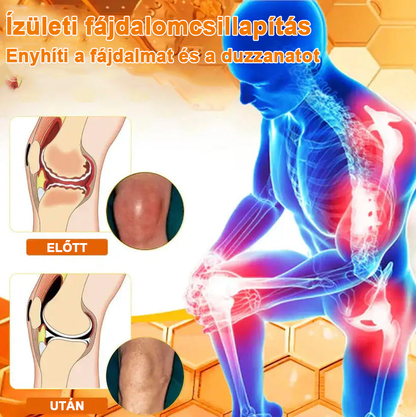 ✅Hivatalos Áruház: Ourlyard™ Magnézium Olaj és Méhméreg ízületjavító spray 👨‍⚕️ A Gyógyszerügyi Hivatal (OGYEI) jóváhagyásával.