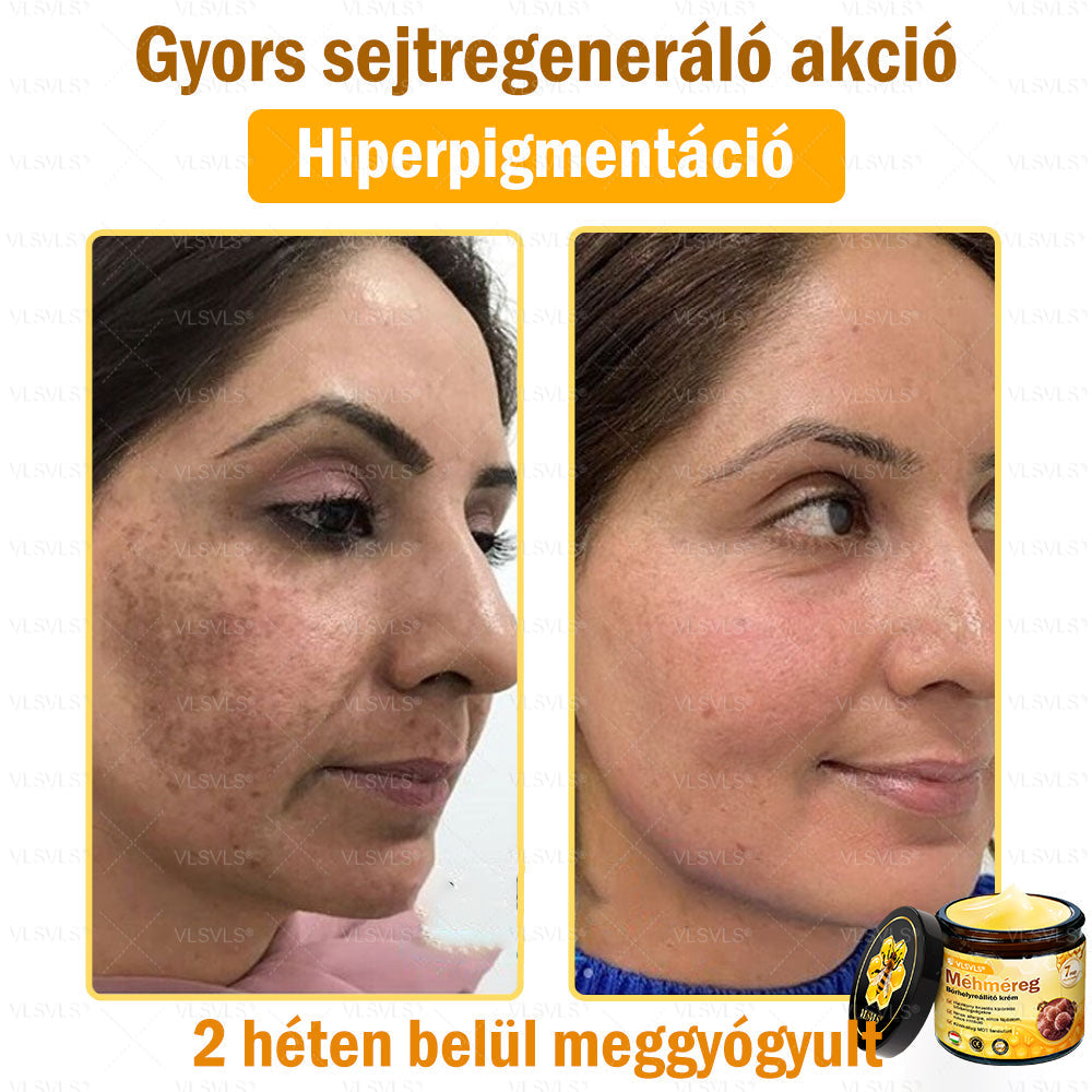 💪VLSVLS® Méhméreg Bőrhelyreállító Krém (👨‍⚕‍CE jóváhagyott)👍✅✅