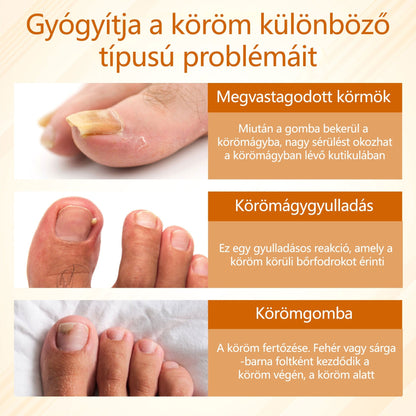 Croaie® Fungiclear Bee Therapy Nail Spray🎁