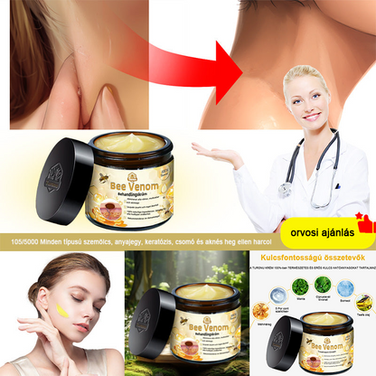 🏵️[Hivatalos zászlóshajó üzlet] 𝑻𝒖𝒓𝒐𝒏𝒖™ méhméreg bőrápoló krém (👨‍⚕𝐀𝐀𝐃 JAVASLATOK)