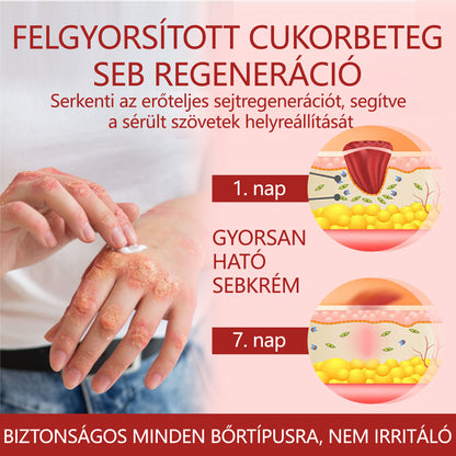 ⭐Laleia® GlucoseGuard bőrmentő krém