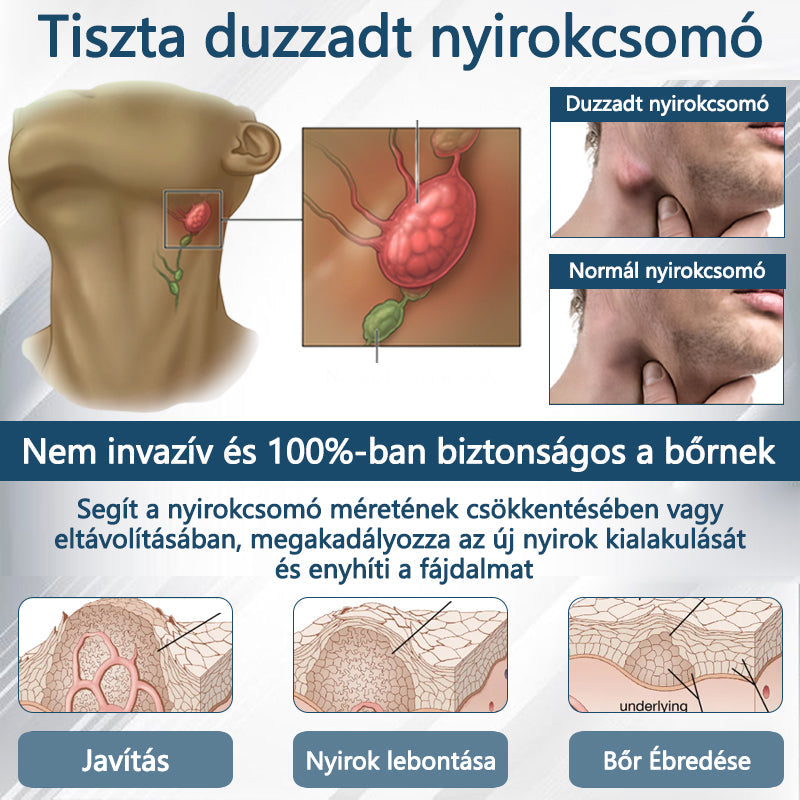 Cvreoz® Fekete kömény Ödéma méregtelenítő gyógynövénykrém🌿🌿