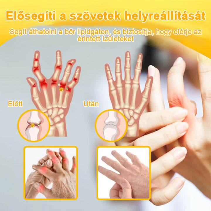 𝐀𝐫𝐭𝐡𝐫𝐨𝐅𝐫𝐞𝐞™Méhméreg fájdalomcsillapító csontgyógyító krém(Különösen az idősebb felnőtteknek és a DGOU által ajánlott) ✨Különleges ajánlat korlátozott ideig✨