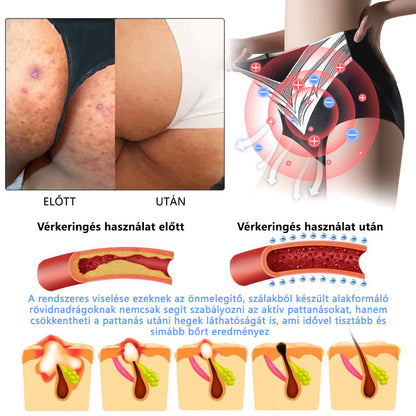 🎉 Korlátozott idejű ajánlat - hatalmas kedvezmény! 🔥 Akár 90% KEDVEZMÉNY! Sfrcord™ titánszálas önmelegedő turmalin formáló rövidnadrág✅