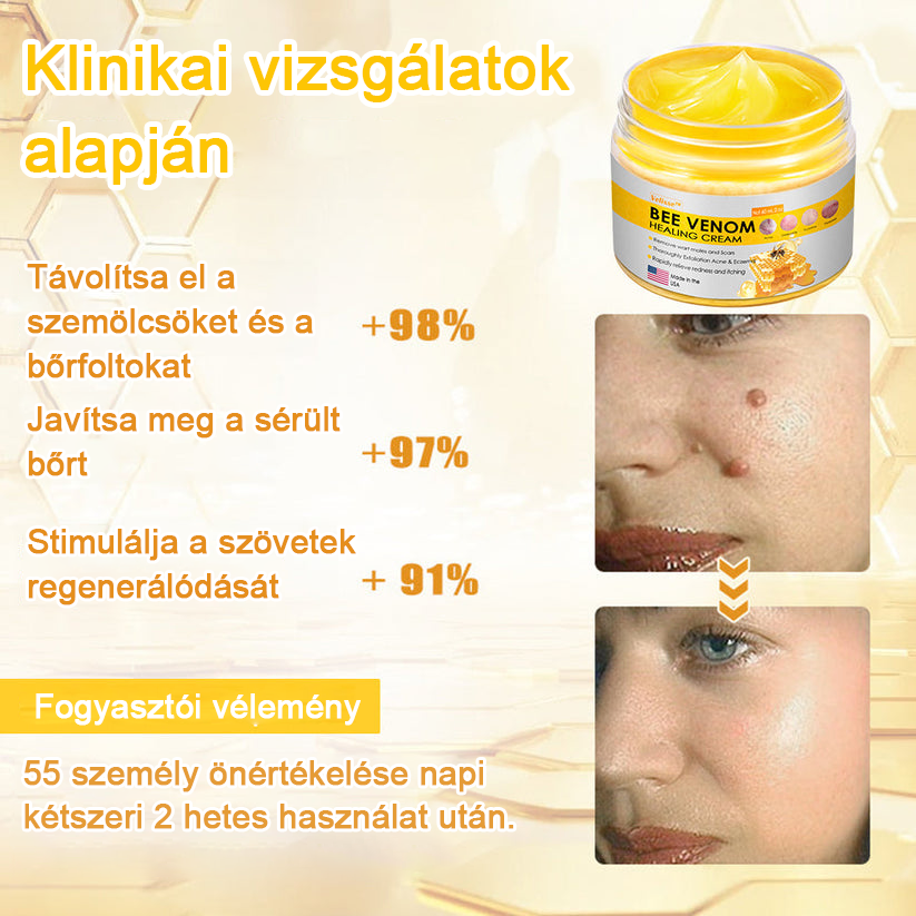 2024 ÚJ Velisse™ méhméreg bőrkrém（🧑‍⚕️AAD ajánlott), a szemölcsök, akné és hegek eltávolítására – többféle bőrbetegség kezelésére