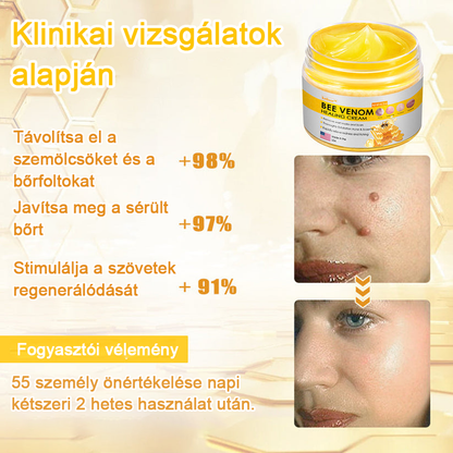 2024 ÚJ Velisse™ méhméreg bőrkrém（🧑‍⚕️AAD ajánlott), a szemölcsök, akné és hegek eltávolítására – többféle bőrbetegség kezelésére