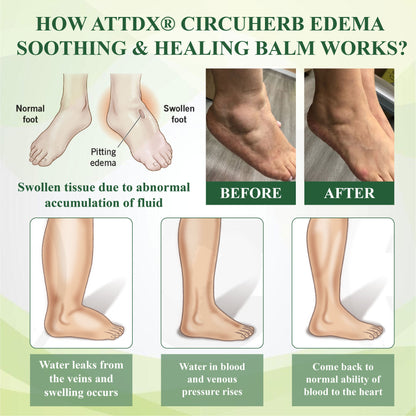 ATTDX® CircuHerb Edema Soothing & Healing Balm