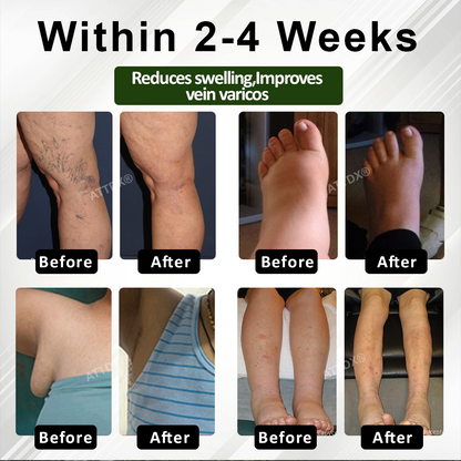 ATTDX® CircuHerb Edema Soothing & Healing Balm