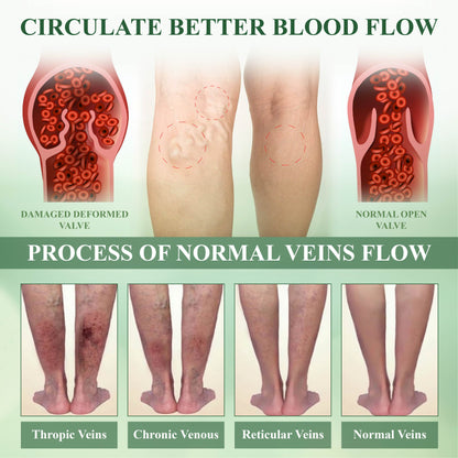 ATTDX® CircuHerb Edema Soothing & Healing Balm