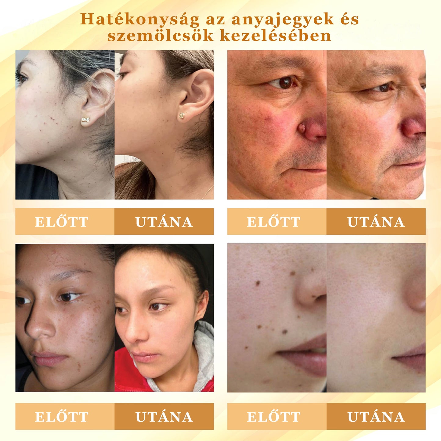 Croaie® Mellifera-méreg sűrítése bőrregeneráló krém💖