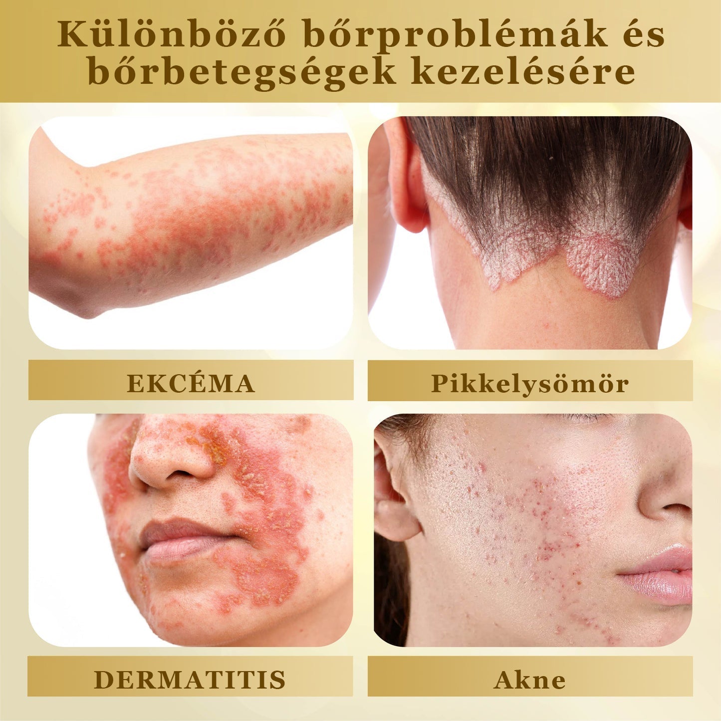 Croaie® Mellifera-méreg sűrítése bőrregeneráló krém💖